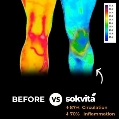 Sokvita™ | Anti-Slip Knee Sleeve